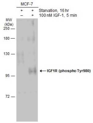 Western Blot: IGF-I R/IGF1R [p Tyr950] Antibody [NBP3-13235]